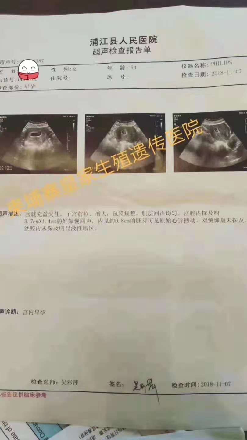 【RFG喜报】53岁高龄国内寻子无道，来RFG移植成功受孕！