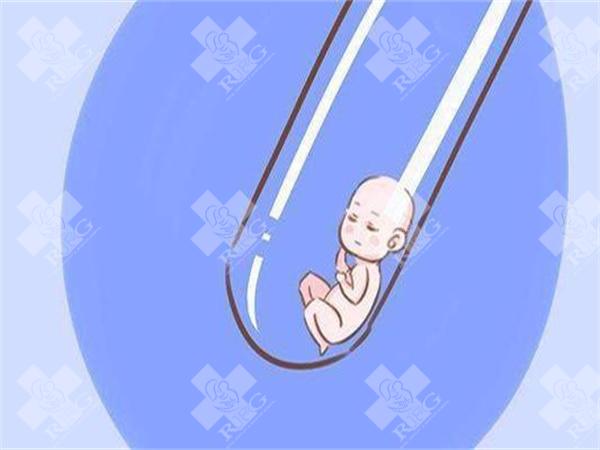 在泰国试管婴儿中需要降调吗？