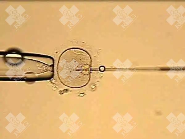 重度宫腔粘连做试管囊胚移植的成功率如何？