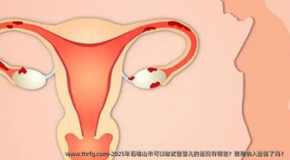 2025年石嘴山市可以做试管婴儿的医院有哪些?费用纳入医保了吗?