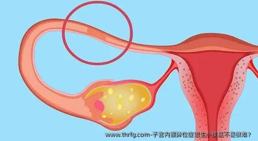 子宫内膜异位症想生小孩是不是很难？