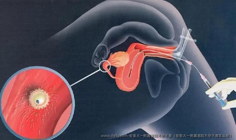 安医大一附属医院不孕不育（安医大一附属医院不孕不育怎么样）