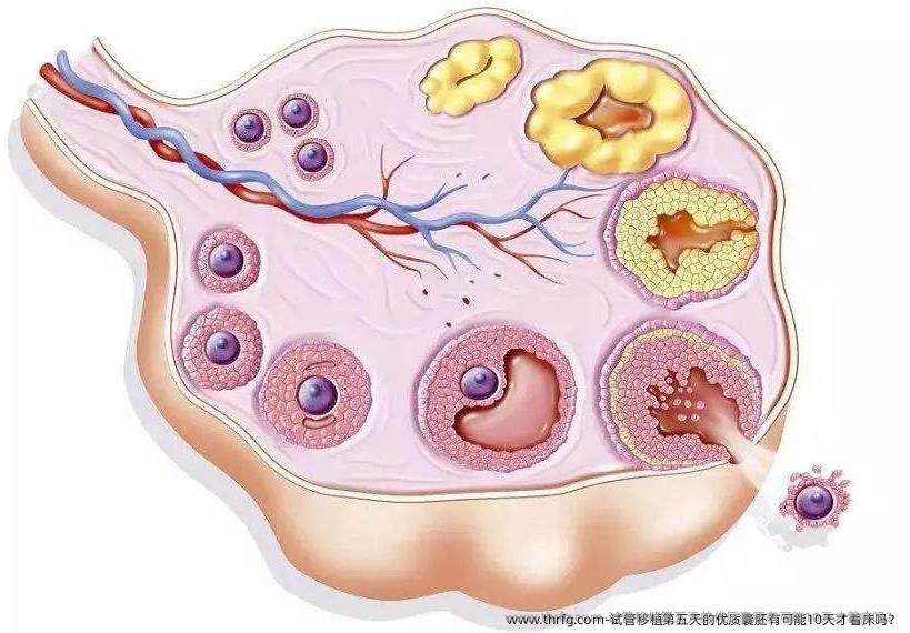 试管移植第五天的优质囊胚有可能10天才着床吗？