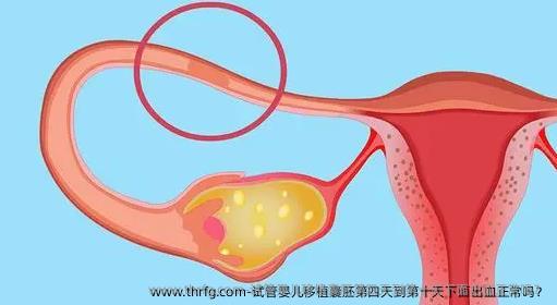 试管婴儿移植囊胚第四天到第十天下面出血正常吗？