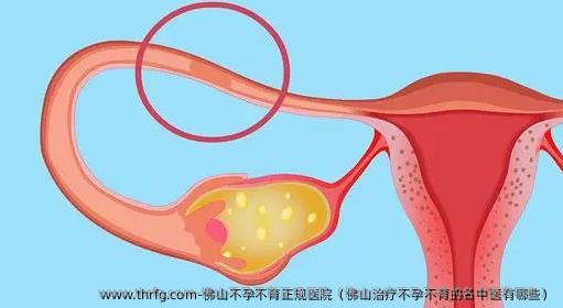 佛山不孕不育正规医院（佛山治疗不孕不育的名中医有哪些）