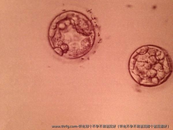 怀化那个不孕不育医院好（怀化不孕不育医院哪个医院较好）