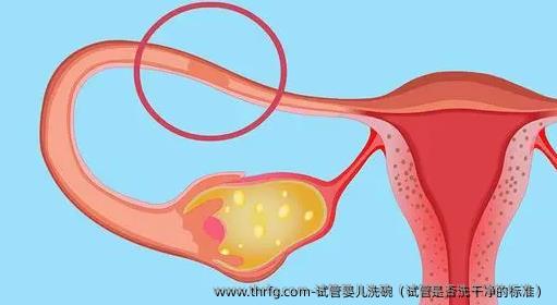 试管婴儿洗碗（试管是否洗干净的标准）