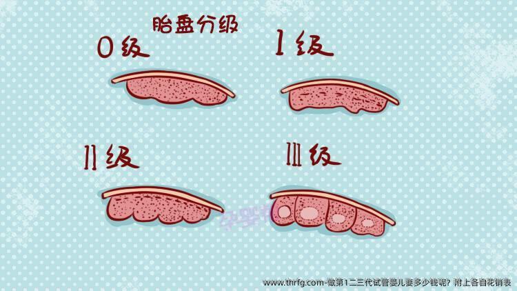 做第1二三代试管婴儿要多少钱呢？附上各自花销表